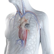 I have a pacemaker or defibrillator, is this product safe for me to use?